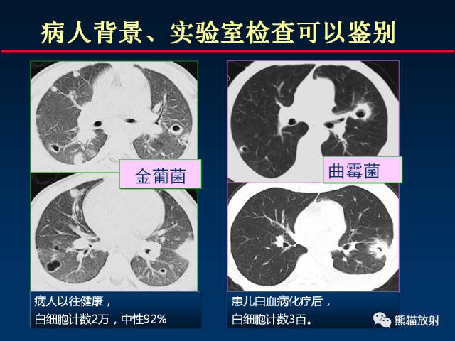 【PPT】影像诊断流程质量控制的重点在哪里？——从CT报告谈起