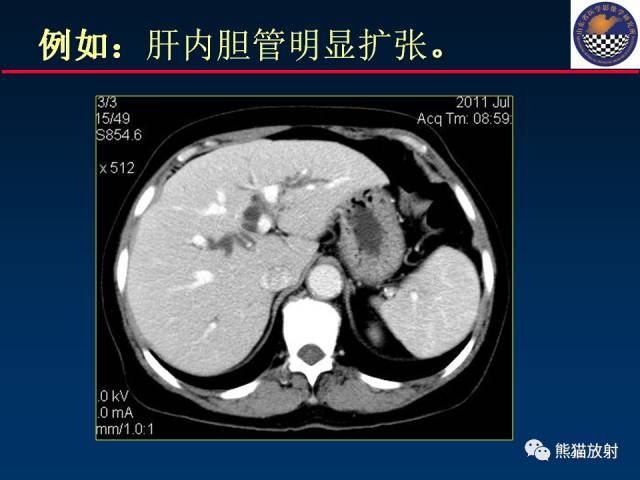 【PPT】影像诊断流程质量控制的重点在哪里？——从CT报告谈起