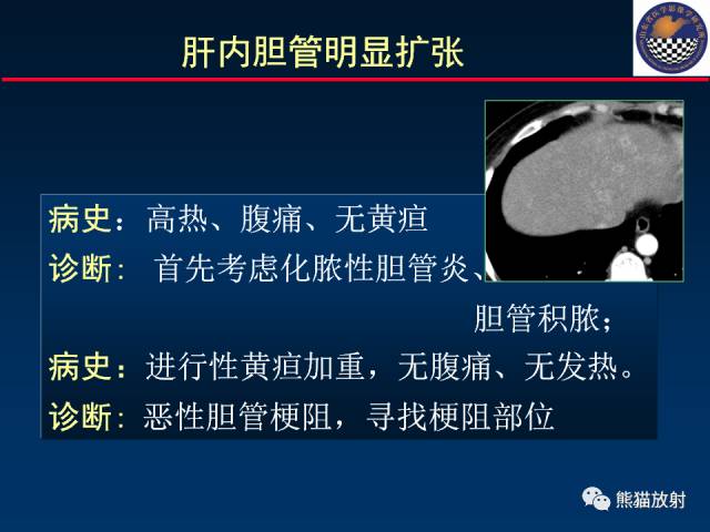 【PPT】影像诊断流程质量控制的重点在哪里？——从CT报告谈起