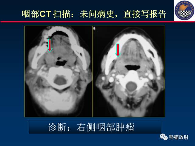 【PPT】影像诊断流程质量控制的重点在哪里？——从CT报告谈起