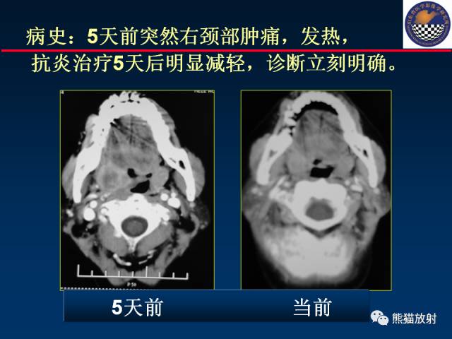 【PPT】影像诊断流程质量控制的重点在哪里？——从CT报告谈起