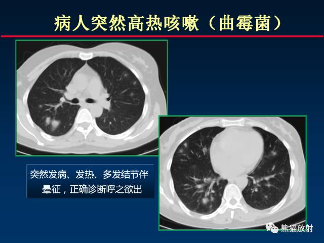 【PPT】影像诊断流程质量控制的重点在哪里？——从CT报告谈起
