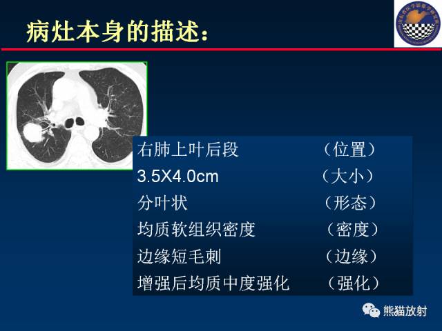 【PPT】影像诊断流程质量控制的重点在哪里？——从CT报告谈起