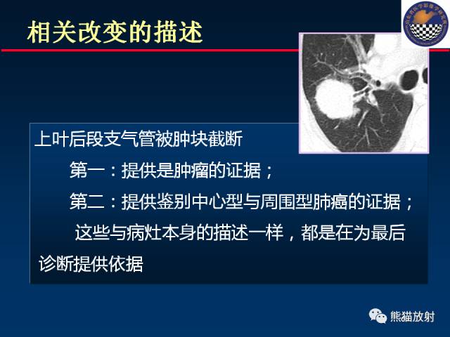 【PPT】影像诊断流程质量控制的重点在哪里？——从CT报告谈起