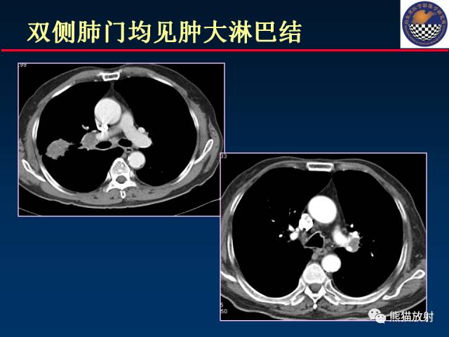 【PPT】影像诊断流程质量控制的重点在哪里？——从CT报告谈起