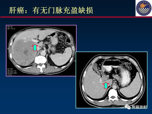 【PPT】影像诊断流程质量控制的重点在哪里？——从CT报告谈起