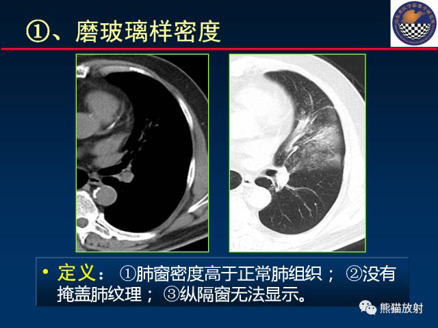 【PPT】影像诊断流程质量控制的重点在哪里？——从CT报告谈起