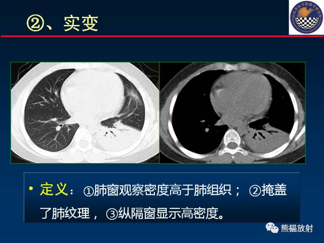 【PPT】影像诊断流程质量控制的重点在哪里？——从CT报告谈起
