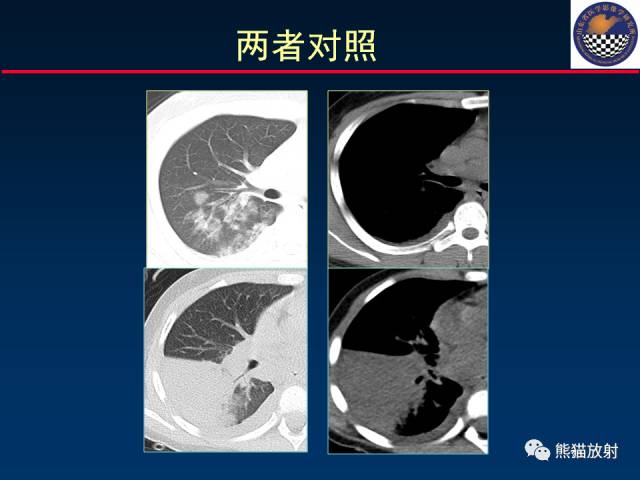 【PPT】影像诊断流程质量控制的重点在哪里？——从CT报告谈起