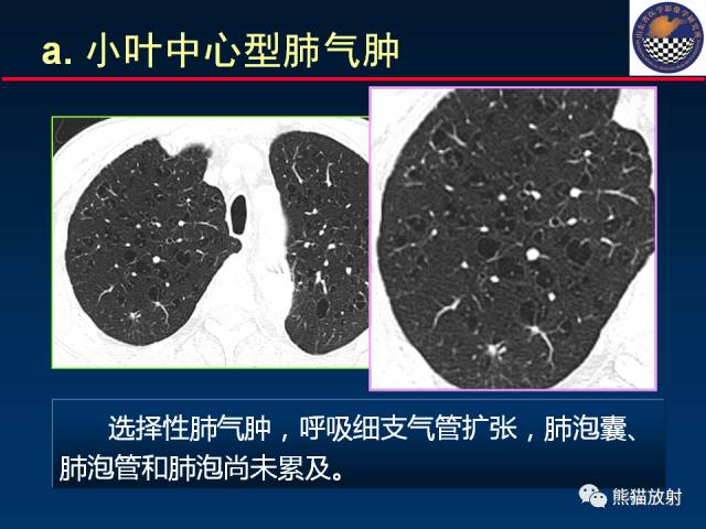 【PPT】影像诊断流程质量控制的重点在哪里？——从CT报告谈起