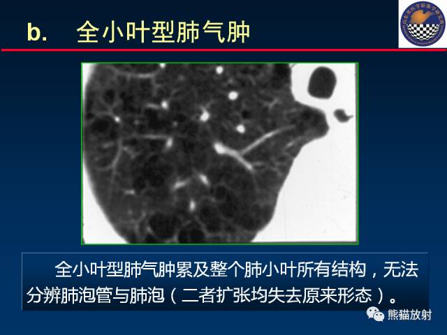 【PPT】影像诊断流程质量控制的重点在哪里？——从CT报告谈起