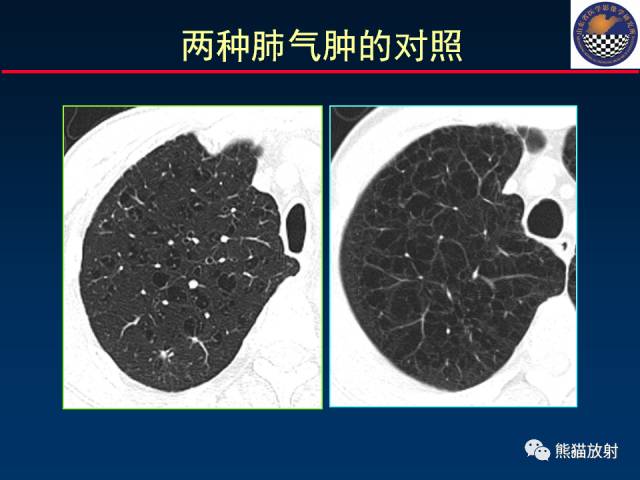 【PPT】影像诊断流程质量控制的重点在哪里？——从CT报告谈起