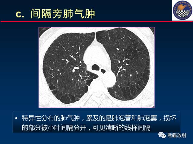 【PPT】影像诊断流程质量控制的重点在哪里？——从CT报告谈起