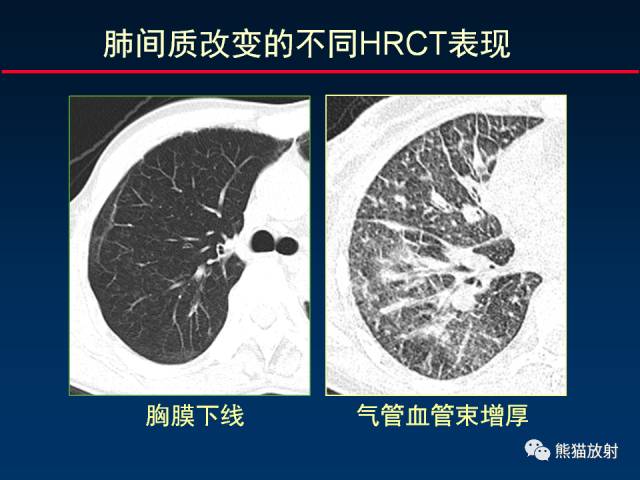 【PPT】影像诊断流程质量控制的重点在哪里？——从CT报告谈起