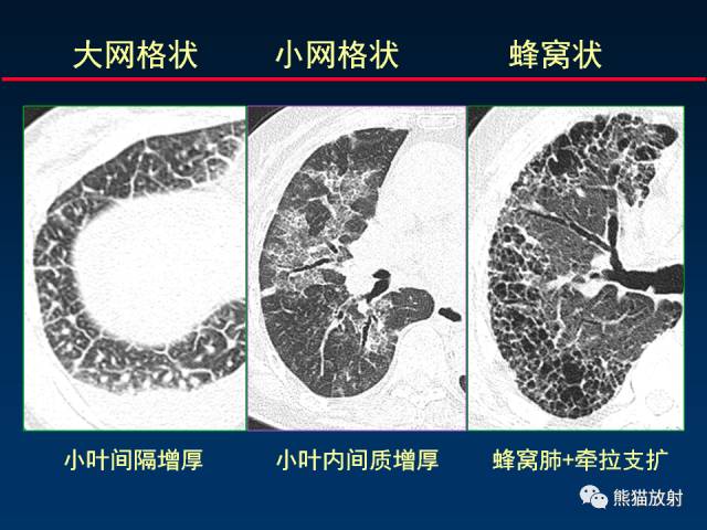 【PPT】影像诊断流程质量控制的重点在哪里？——从CT报告谈起