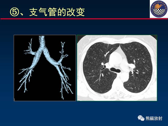 【PPT】影像诊断流程质量控制的重点在哪里？——从CT报告谈起