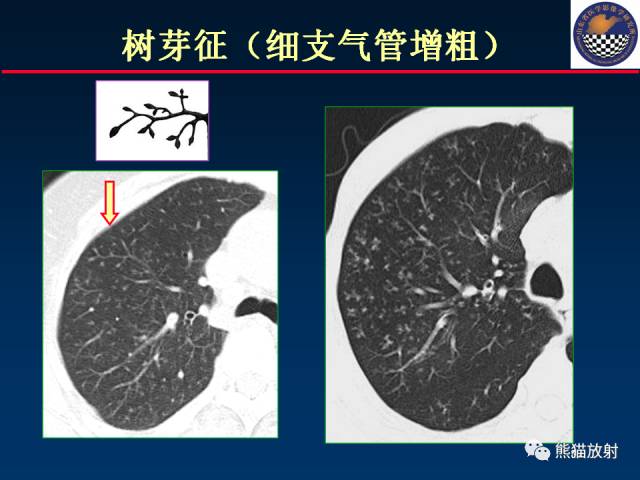 【PPT】影像诊断流程质量控制的重点在哪里？——从CT报告谈起