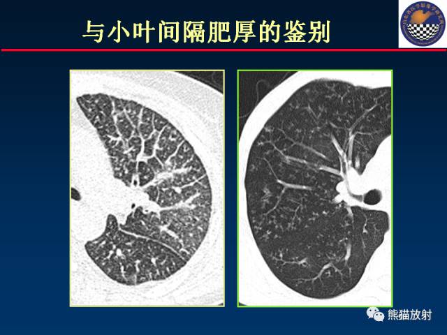 【PPT】影像诊断流程质量控制的重点在哪里？——从CT报告谈起