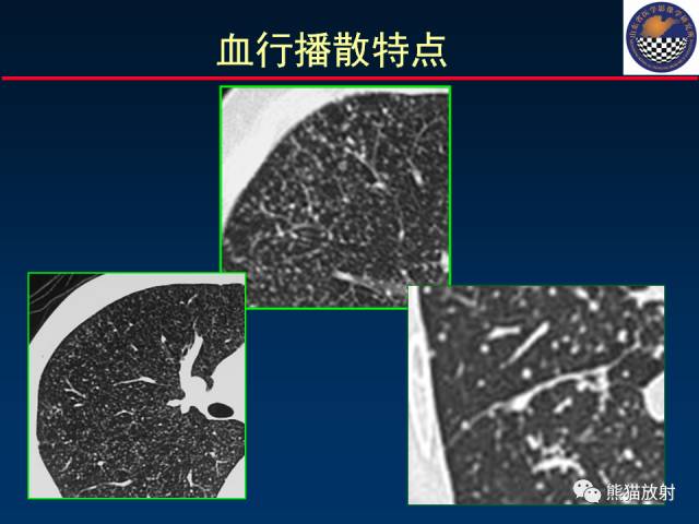 【PPT】影像诊断流程质量控制的重点在哪里？——从CT报告谈起