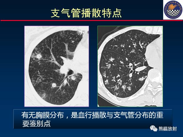 【PPT】影像诊断流程质量控制的重点在哪里？——从CT报告谈起