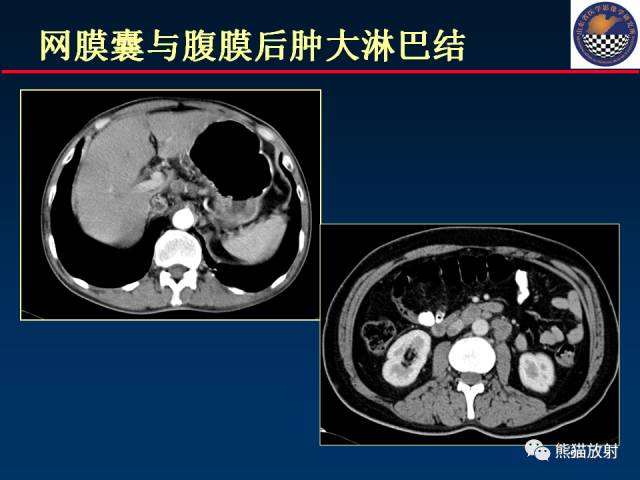 【PPT】影像诊断流程质量控制的重点在哪里？——从CT报告谈起