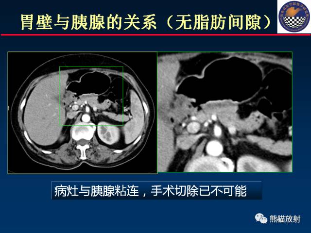【PPT】影像诊断流程质量控制的重点在哪里？——从CT报告谈起
