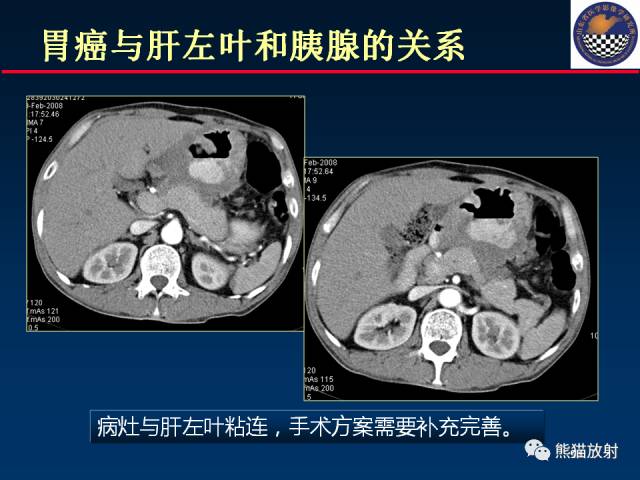 【PPT】影像诊断流程质量控制的重点在哪里？——从CT报告谈起