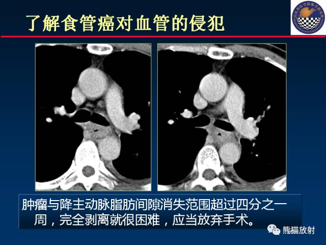 【PPT】影像诊断流程质量控制的重点在哪里？——从CT报告谈起
