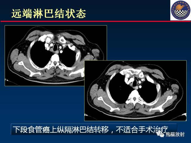 【PPT】影像诊断流程质量控制的重点在哪里？——从CT报告谈起