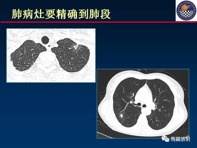 【PPT】影像诊断流程质量控制的重点在哪里？——从CT报告谈起