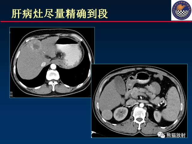【PPT】影像诊断流程质量控制的重点在哪里？——从CT报告谈起