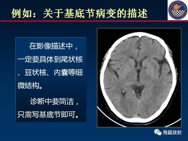 【PPT】影像诊断流程质量控制的重点在哪里？——从CT报告谈起