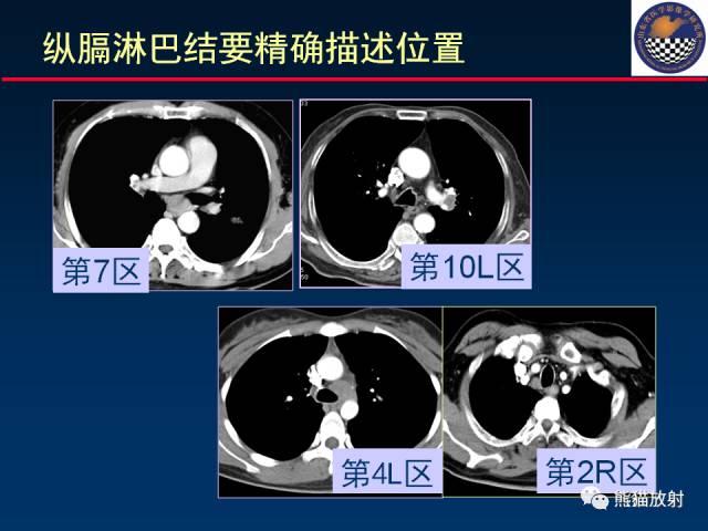 【PPT】影像诊断流程质量控制的重点在哪里？——从CT报告谈起