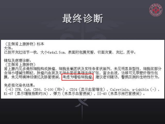 【病例】左侧肾上腺嗜铬细胞瘤1例CT