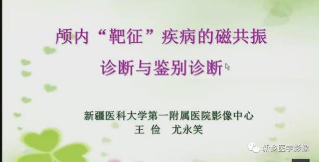 【PPT】颅内“靶征”疾病的影像诊断与鉴别
