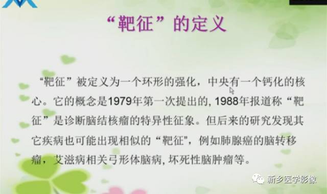 【PPT】颅内“靶征”疾病的影像诊断与鉴别