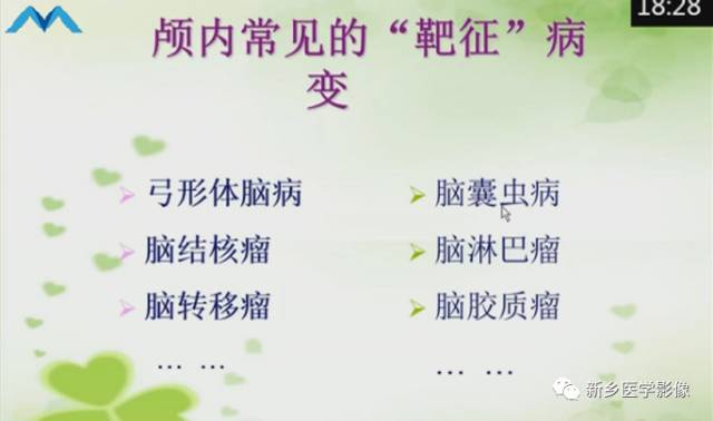 【PPT】颅内“靶征”疾病的影像诊断与鉴别
