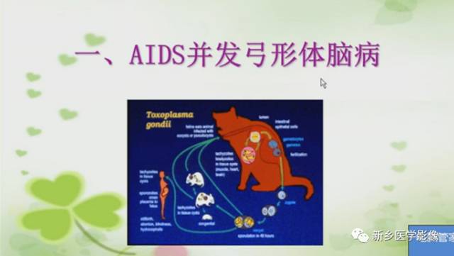 【PPT】颅内“靶征”疾病的影像诊断与鉴别