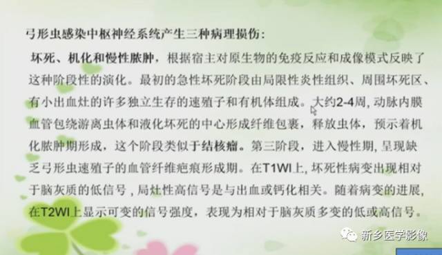 【PPT】颅内“靶征”疾病的影像诊断与鉴别