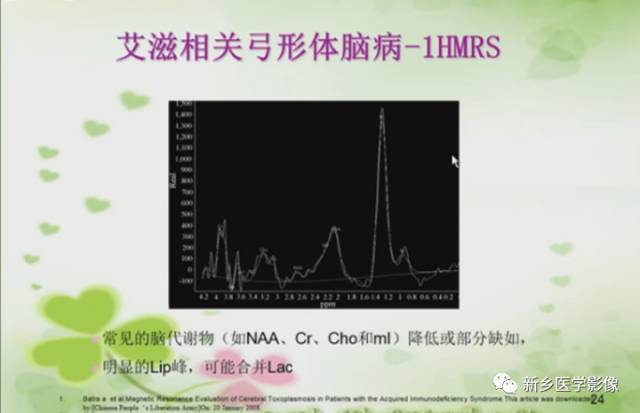 【PPT】颅内“靶征”疾病的影像诊断与鉴别