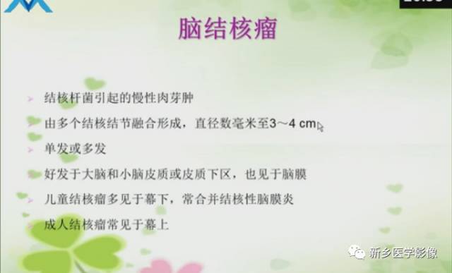 【PPT】颅内“靶征”疾病的影像诊断与鉴别