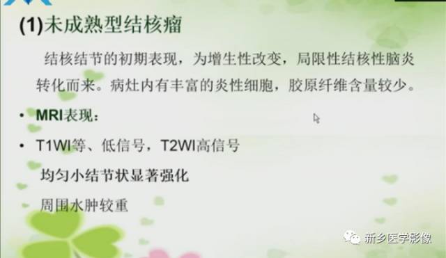 【PPT】颅内“靶征”疾病的影像诊断与鉴别