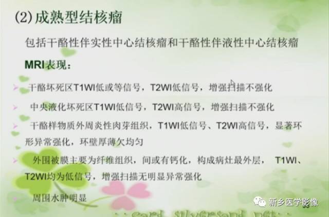 【PPT】颅内“靶征”疾病的影像诊断与鉴别