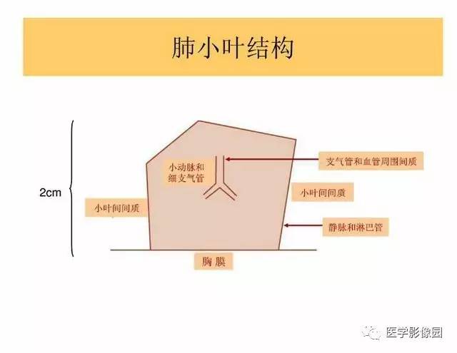 【PPT】DPLD胸部HRCT鉴别诊断