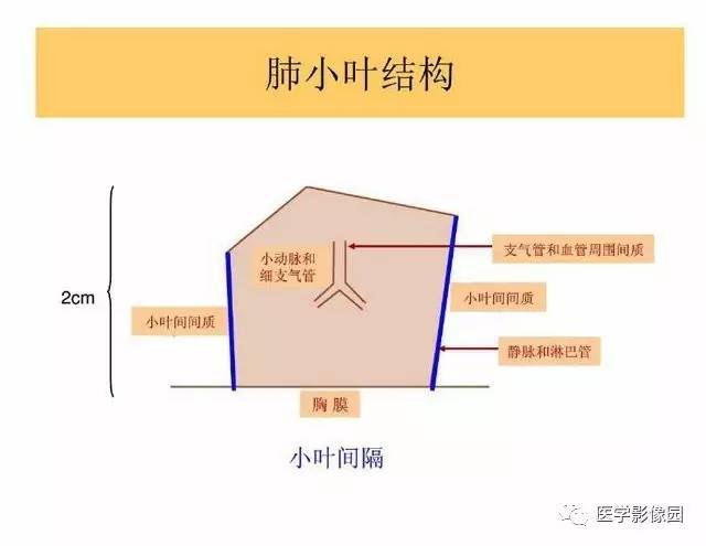 【PPT】DPLD胸部HRCT鉴别诊断