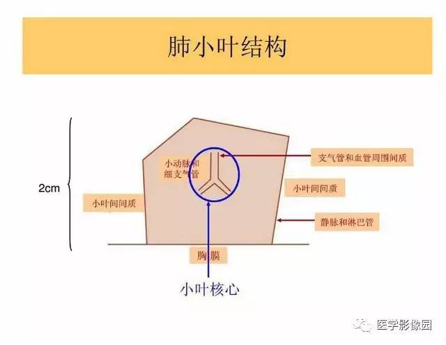 【PPT】DPLD胸部HRCT鉴别诊断