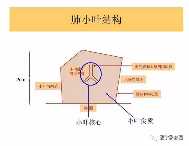 【PPT】DPLD胸部HRCT鉴别诊断
