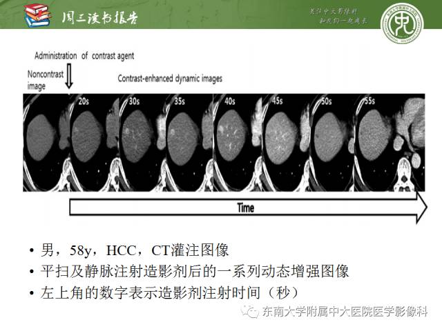 【PPT】肝脏CT灌注在肿瘤学中的原理及应用