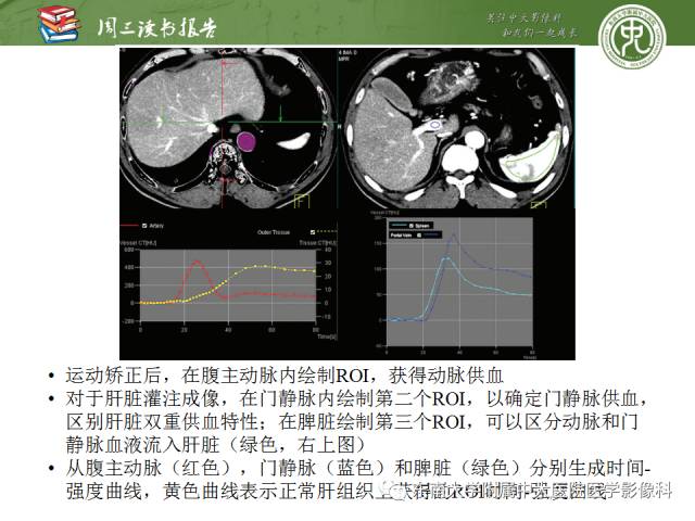 【PPT】肝脏CT灌注在肿瘤学中的原理及应用