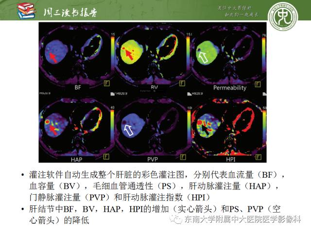 【PPT】肝脏CT灌注在肿瘤学中的原理及应用